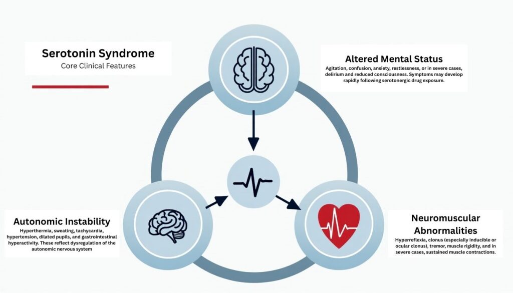 Infographic showing the three core features of serotonin syndrome: altered mental status, autonomic instability, and neuromuscular abnormalities.